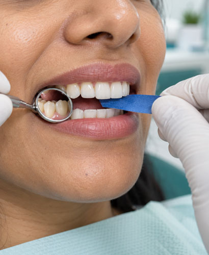 Dental Crown Treatment