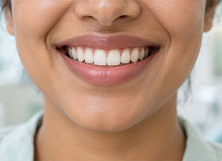 Perfect Smile