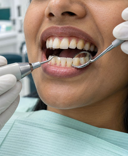 Teeth Cleaning