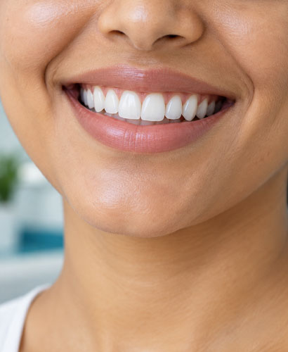 Teeth Whitening
